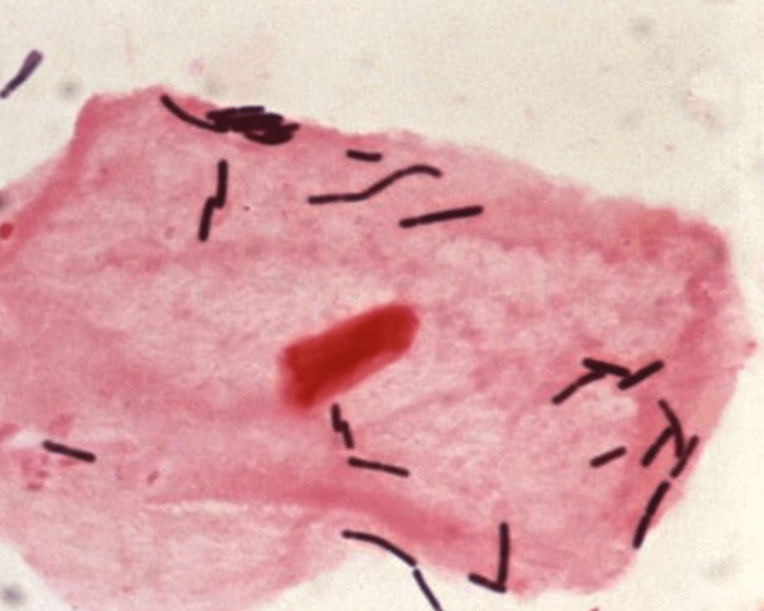 lactic acid bacteria